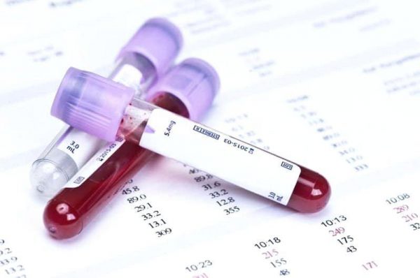 Dựa vào công thức máu để chẩn đoán bệnh chính xác viêm phúc mạc nhiễm khuẩn nguyên phát