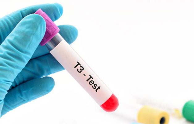 Các xét nghiệm đánh giá chức năng tuyến giáp phổ biến