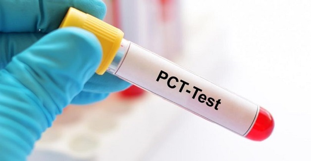 bao cần cần thực hiện xét nghiệm PCT
