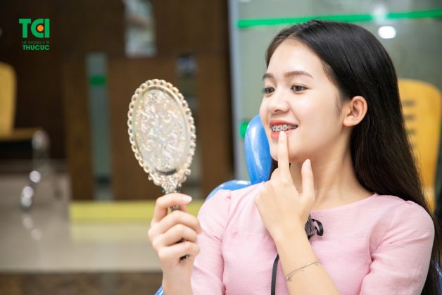 nẹp răng vổ