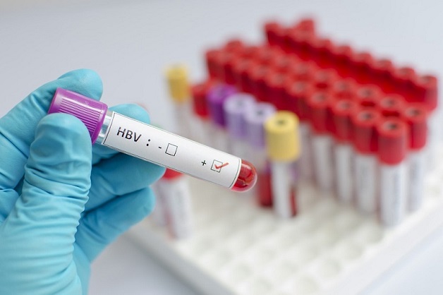xét nghiệm HBV phát hiện bệnh gì