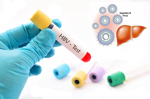 xét nghiệm HBV phát hiện bệnh gì