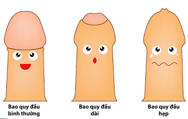 Hẹp bao quy đầu là tình trạng mà vòng bao quy đầu bị chít hẹp ở các mức độ khác nhau và không thể lộn được bao quy đầu ra ngoài