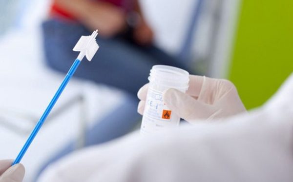 xét nghiệm Cobas test