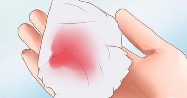 Dịch nhầy âm đạo thay đổi màu sắc và đặc dính hơn là dấu hiệu sắp sinh lần 3