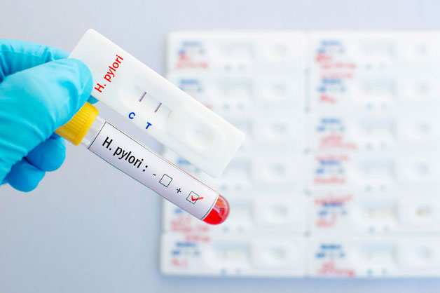 xét nghiệm H.pylori dương tính là gì