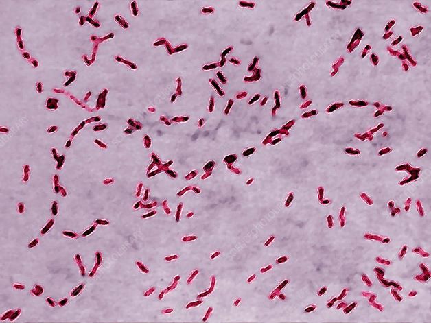 Ho gà là một bệnh truyền nhiễm phổ biến mỗi khi giao mùa, do vi khuẩn Bordetella pertussis gây ra.