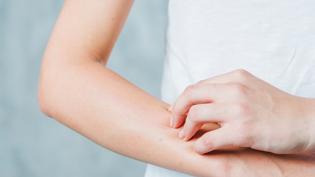 Mẩn ngứa là một trong những triệu chứng điển hình của bệnh gan