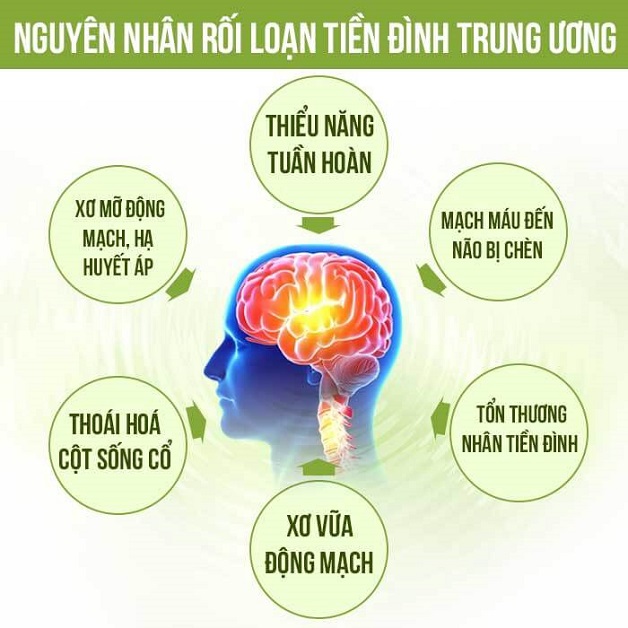các nguyên nhân gây rối loạn hệ thống tiền đình trung ương
