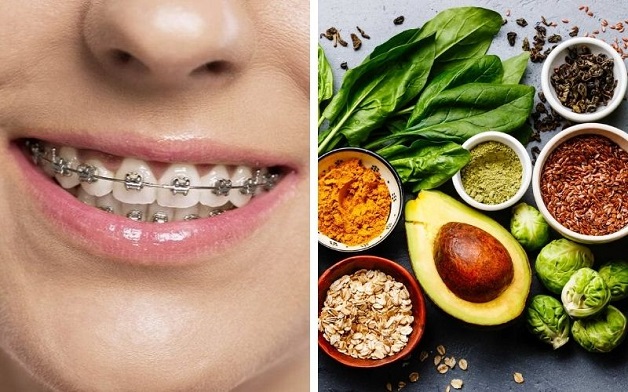 Để tránh tình trạng niềng răng bị hóp má đồng thời đảm bảo sức khỏe bản thân, nên xây dựng chế độ ăn uống hợp lý và khoa học, không nên kiêng khem quá kĩ dẫn đến thiếu chất.