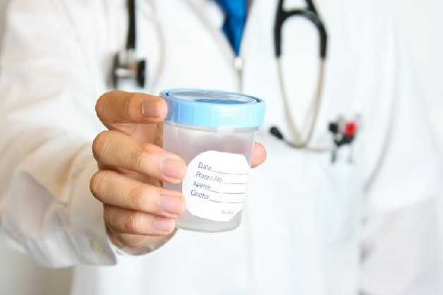 Tinh dịch đồ là xét nghiệm quan trọng để đánh giá khả năng sinh sản của nam giới