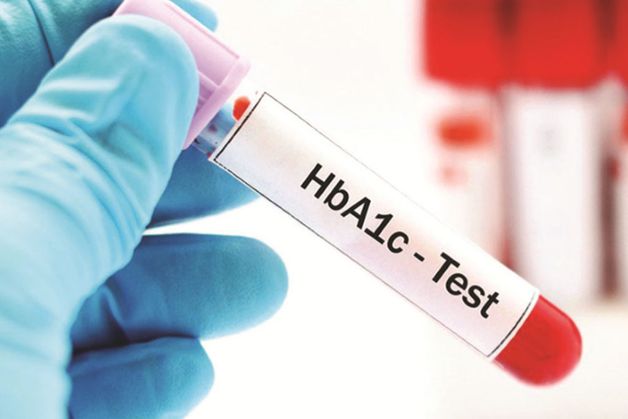 xét nghiệm HbA1c