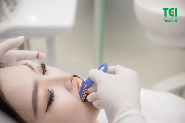 Bệnh nhân được lấy dấu răng và gửi đến phòng Labo để thực hiện sản xuất răng sứ
