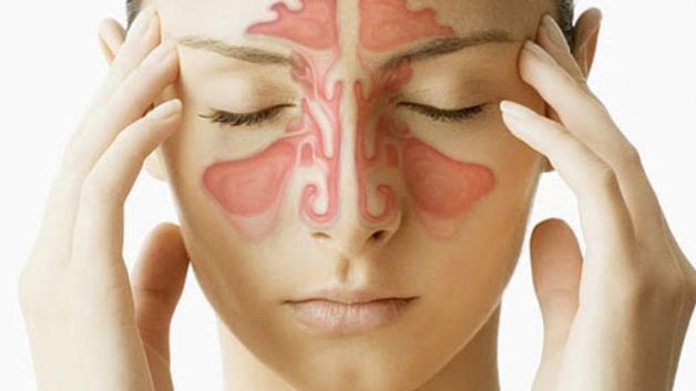 bệnh viêm xoang mũi có nguy hiểm không