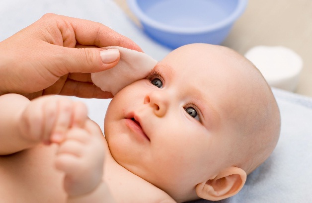 Bố mẹ nên phòng ngừa viêm kết mạc cho trẻ sơ sinh bằng cách vệ sinh mắt sạch sẽ hàng ngày cho trẻ