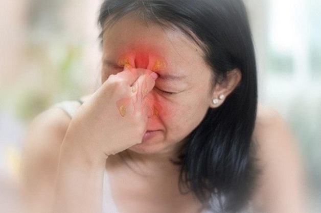 viêm xoang mạn tính