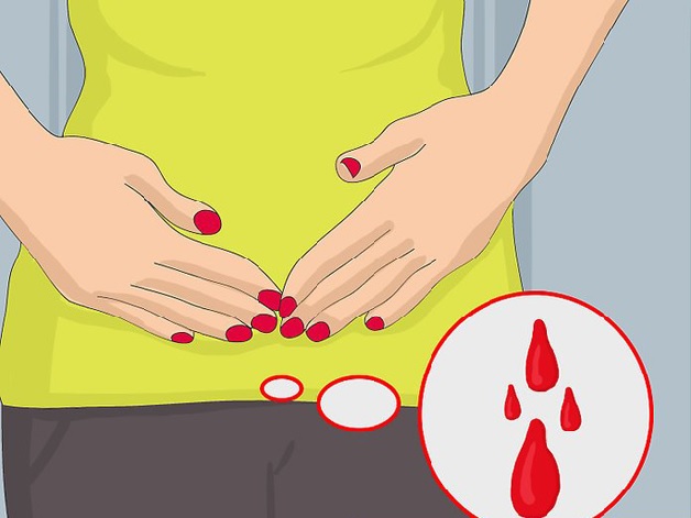 Chảy máu âm đạo bất thường là dấu hiệu mang thai ngoài tử cung