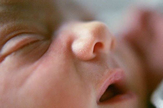 Có nhiều nguyên nhân khiến trẻ sơ sinh bị viêm kết mạc
