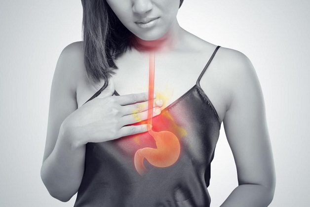 Có vi khuẩn Hp trong dạ dày gây triệu chứng ợ nóng, ợ hơi, ợ chua