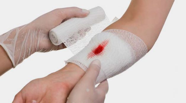 Tiểu đường tuýp 2 - Là tình trạng các tế bào không đáp ứng insulin mặc dù cơ thể vẫn hoạt động và tạo ra insulin mà một trong những biểu hiện của nó là vết thương hở lâu lành.