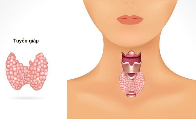 Mổ u tuyến giáp có cần kiêng nói không?