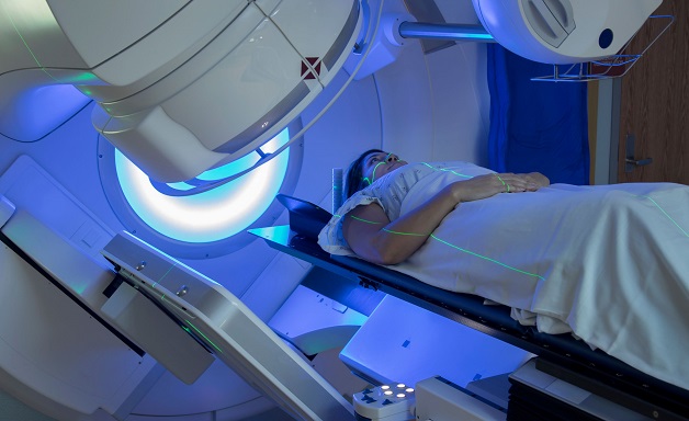 Điều trị ung thư vú bằng xạ trị ngoài