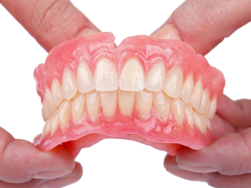 Trồng răng giả bằng phương pháp dùng hàm tháo lắp