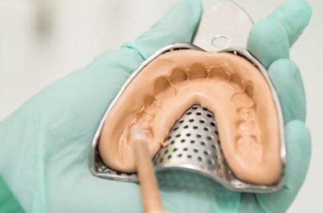 Khách hàng thực hiện lấy dấu răng ở phòng khám đối tác của Zenyum.