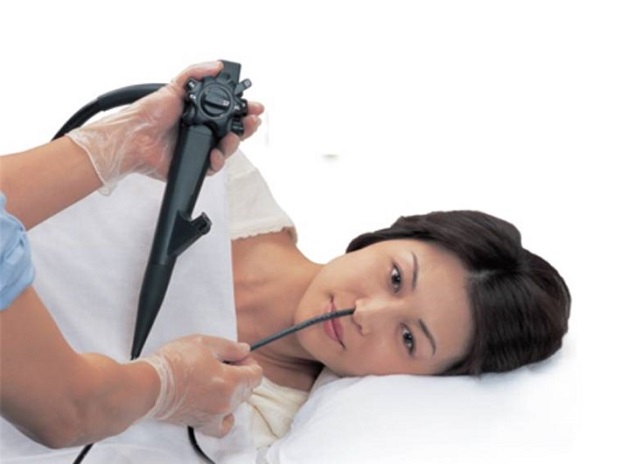 Người bệnh tỉnh táo trong toàn bộ quá trình nội soi dạ dày qua đường mũi