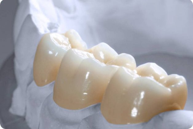 răng sứ ZIrconia được sử dụng phổ biến hiện nay vì có những ưu điểm vượt trội