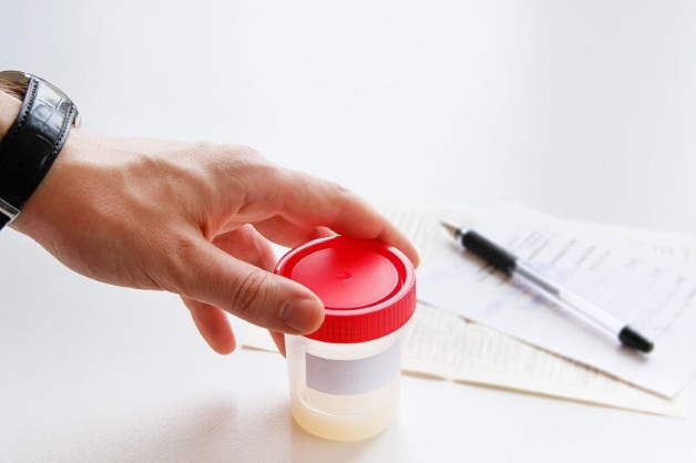 Lấy mẫu tinh dịch có thể thực hiện tại nhà hoặc tại phòng khám