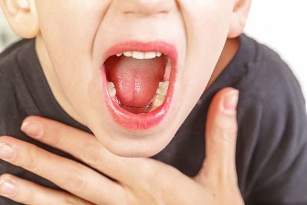 Bệnh ung thư vòm họng có chữa khỏi được không khi ở giai đoạn II và III?