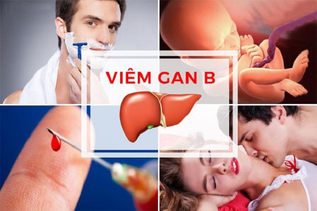 Viêm gan B lây qua những con đường nào? Bệnh có thể lây lan qua nhiều con đường khác nhau