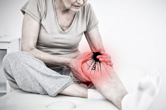 Biểu hiện của bệnh viêm khớp do vi khuẩn liên cầu