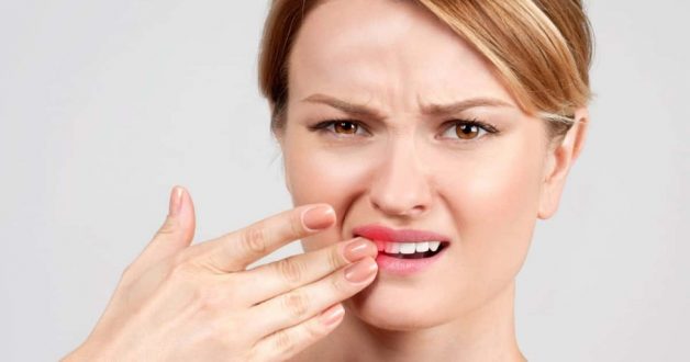 Nhổ răng khôn tại các cơ sở kém chất lượng có thể gây nên tình trạng sót chân răng, sưng nướu và bệnh nhân bị sốt