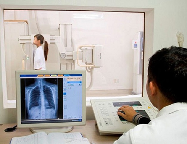 chụp x quang có phải cởi áo không