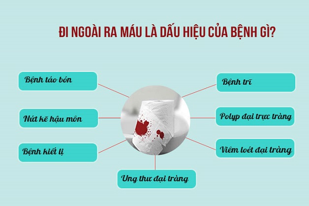 máu trong phân dấu hiệu nhận biết ung thư đại tràng