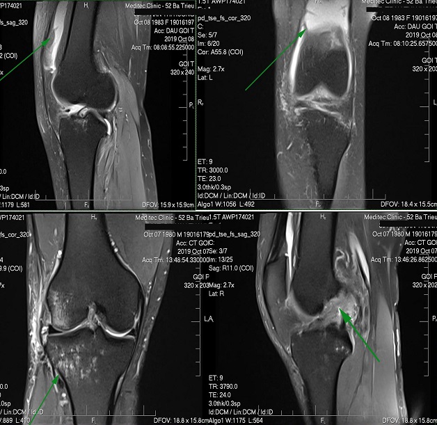 Kết quả chụp MRI cho thấy những hình ảnh rõ nét ở từng vùng chụp