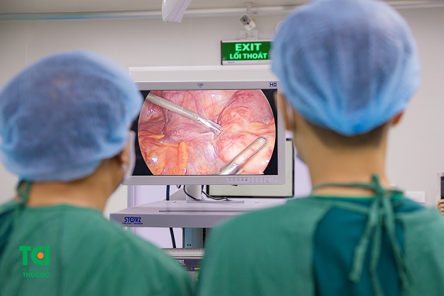 viêm ruột thừa có mổ không giải đáp
