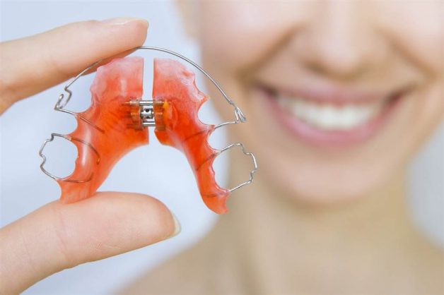 Sau khi tháo niềng, bác sĩ sẽ cho bệnh nhân đeo hàm duy trì để răng không xô lệch khỏi vị trí mới