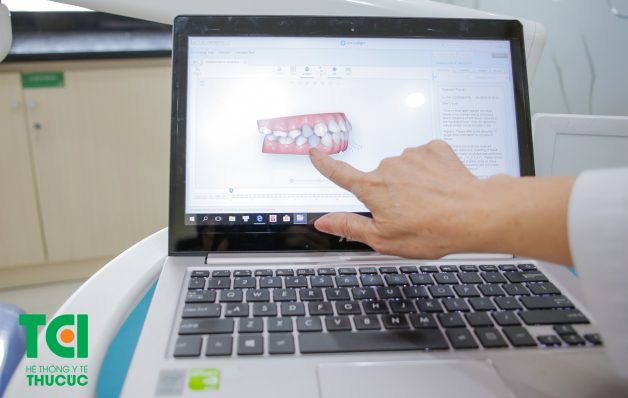Bệnh nhân có thể thấy rõ sự thay đổi của cung hàm và các răng cho đến khi hoàn tất quá trình niềng răng qua màn hình 3D