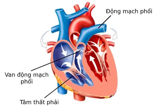pap trong siêu âm tim dùng để tính áp lực động mạch phổi