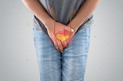 Phương pháp tán sỏi bàng quang như thế nào
