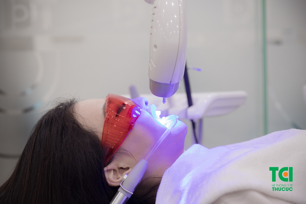 Tẩy trắng răng bằng chiếu plasma là phương pháp tẩy trắng răng an toàn, hiệu quả nhất hiện nay