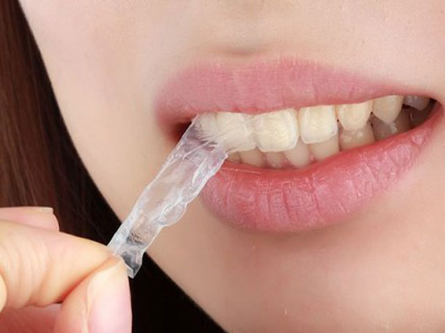 Tẩy trắng răng bằng miếng dán trắng răng