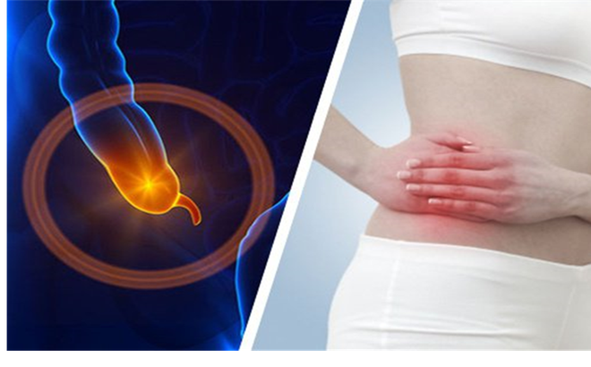 Thời gian ủ bệnh viêm ruột thừa cần nhớ