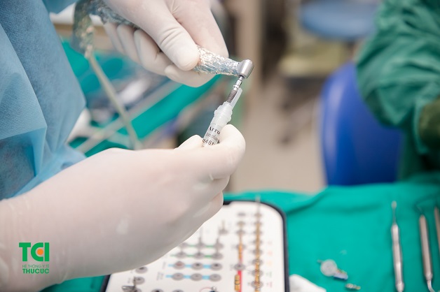 Trồng răng Implant là phương pháp khắc phục mất răng ưu việt nhất hiện nay