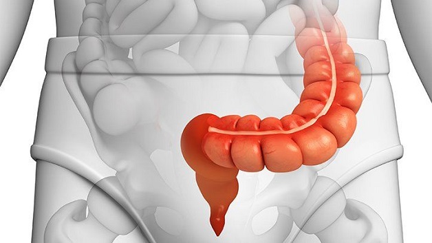 Đại tràng sigma là phần cuối cùng của ruột, nối với trực tràng