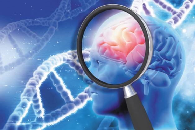Bệnh Alzheimer có di truyền hay không 