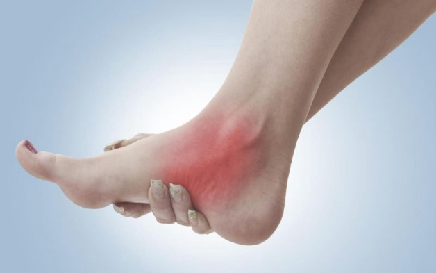 viêm khớp mắt cá chân